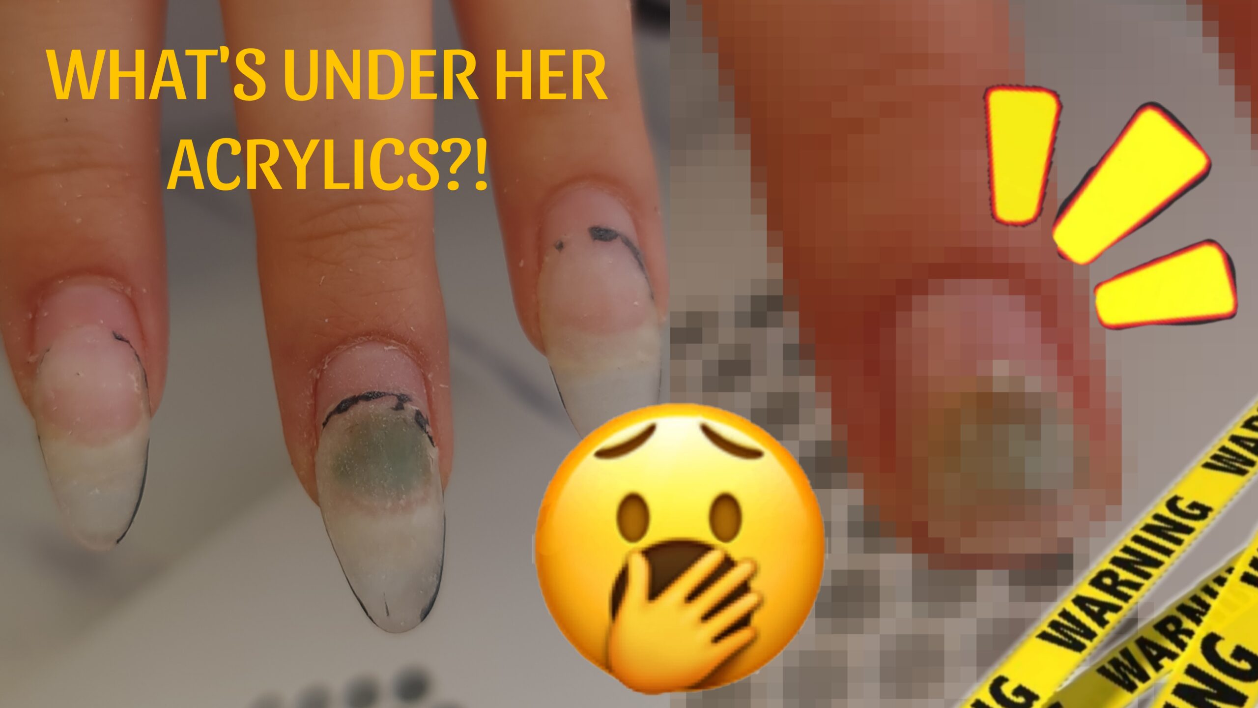 Understanding Green Nail Syndrome ‘greenies’: Causes, Symptoms, and Prevention